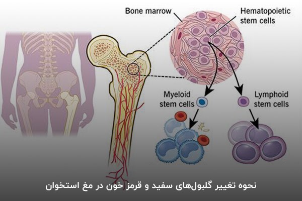 بافت‌های مختلف مغز استخوان در سرطان خون درگیر می‌شود