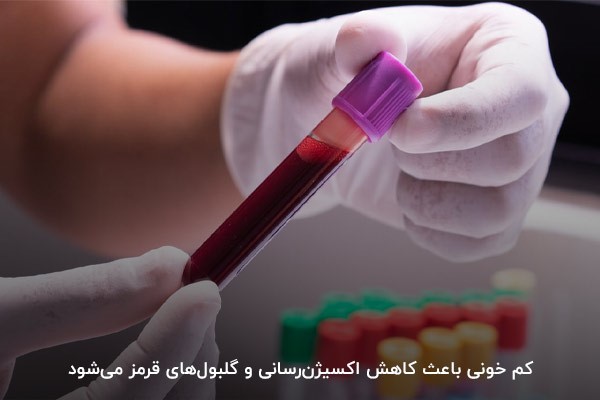 آزمایش خون برای تشخیص بیماری کم‌خونی مزمن