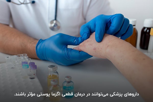 تجویز دارو برای درمان اگزما توسط پزشک