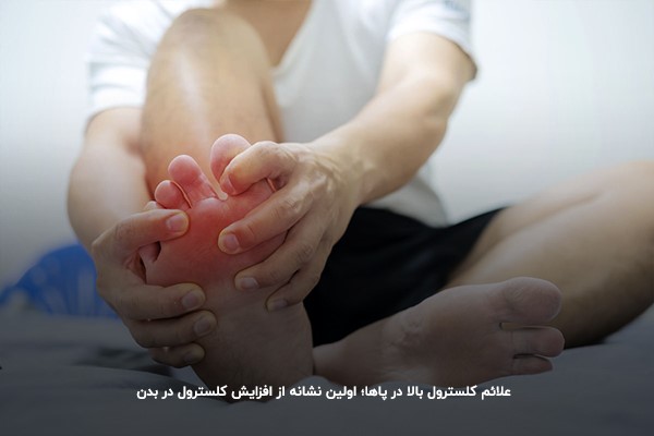 علائم کلسترول بالا در پاها؛ اولین نشانه‌ از افزایش کلسترول در بدن 