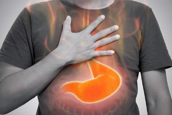 رفلاکس معده چیست؟