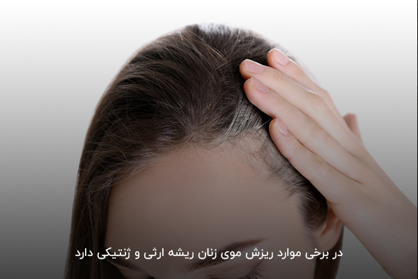 وراثت یکی از دلایل ریزش موی شدید در زنان