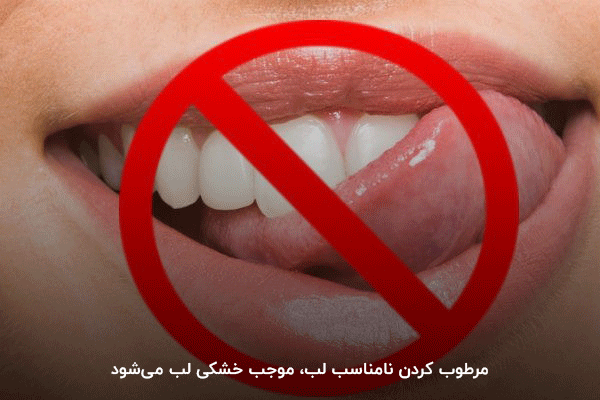 استفاده از بزاق دهان در مرطوب کردن لب؛ یک دلیل شایع برای خشکی لب