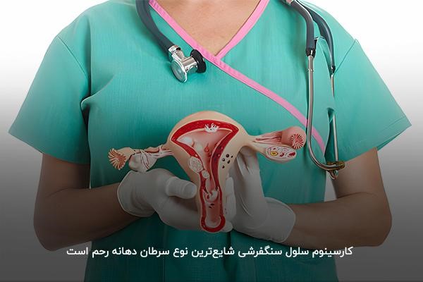 انواع سرطان دهانه رحم