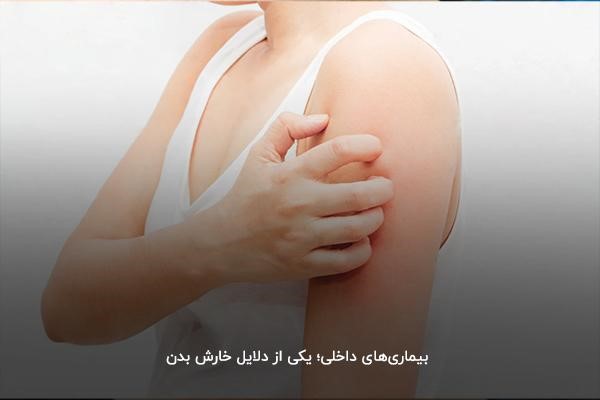 بررسی دلایل خارش بدن