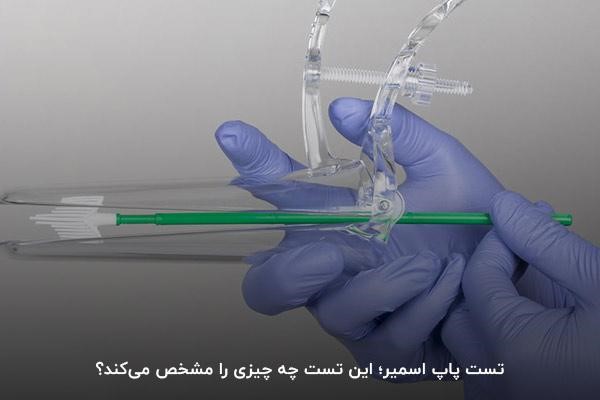 تست پاپ اسمیر؛ این تست چه چیزی را مشخص می‌کند؟