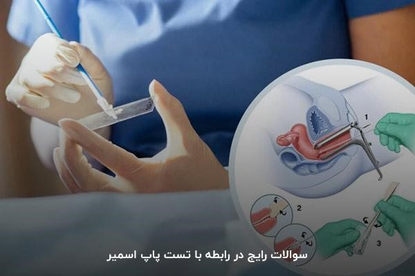 سوالات رایج در رابطه با تست پاپ اسمیر