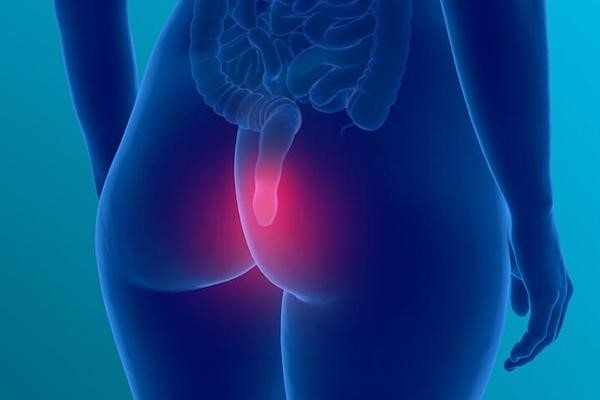 بررسی علائم و روش‌های درمان سرطان مقعد در مجله آدوراطب 