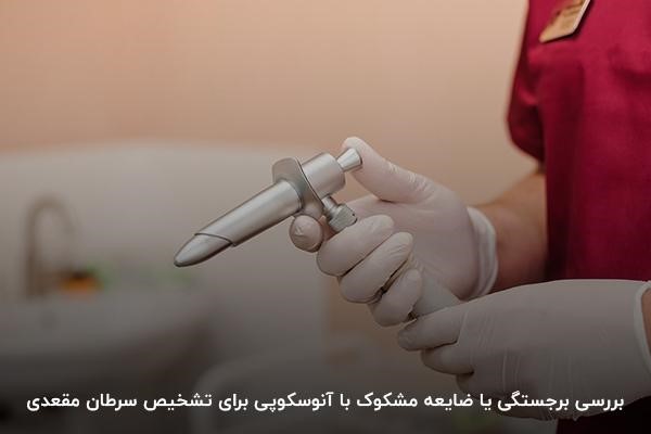 بررسی برجستگی یا زائده مشکوک به سرطان مقعدی با آنوسکوپی