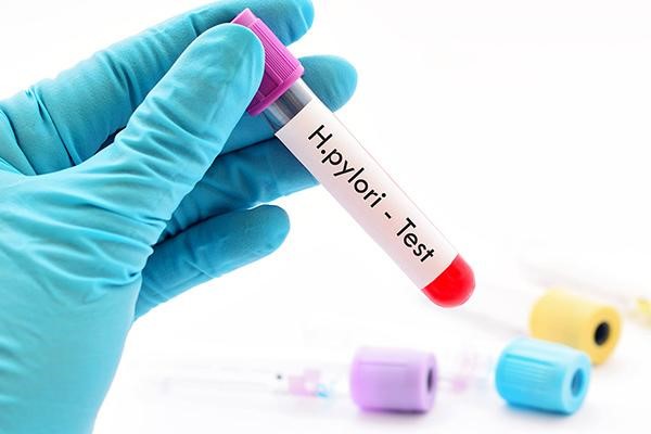 بررسی انواع و نحوه خواندن آزمایش میکروب معده در مجله آدوراطب