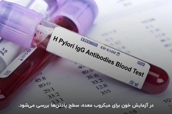 بررسی سطح پادتن بدن در آزمایش میکروب معده از طریق خون

