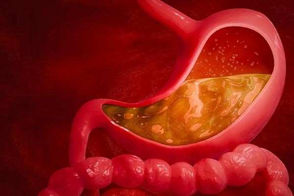 بررسی این‌که اسید معده چیست در مجله آدوراطب