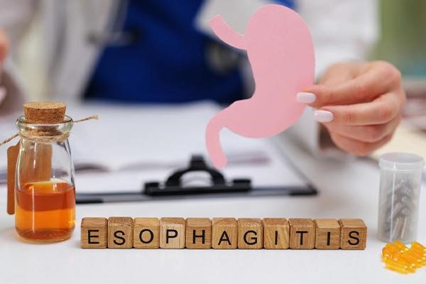 بررسی روش‌های درمان و علائم ازوفاژیت در مجله آدوراطب