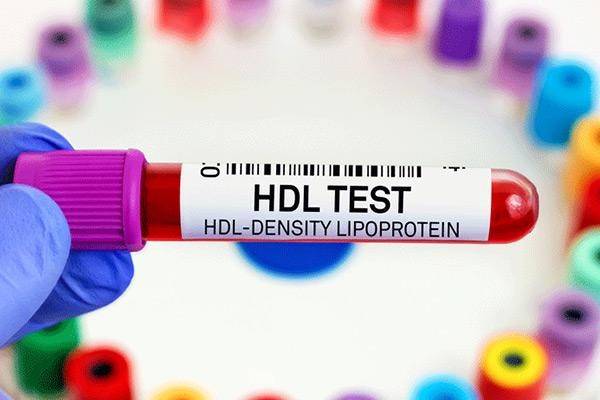 بررسی این‌که hdl در آزمایش خون چیست در مجله آدوراطب