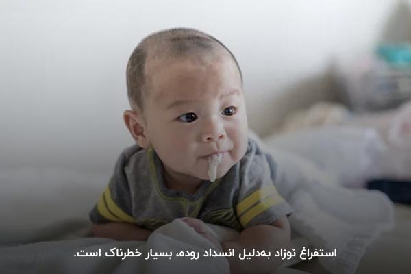 استفراغ کودک به دلیل انسداد روده