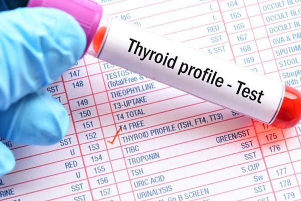 بررسی این‌که tsh در آزمایش خون چیست در مجله آدوراطب